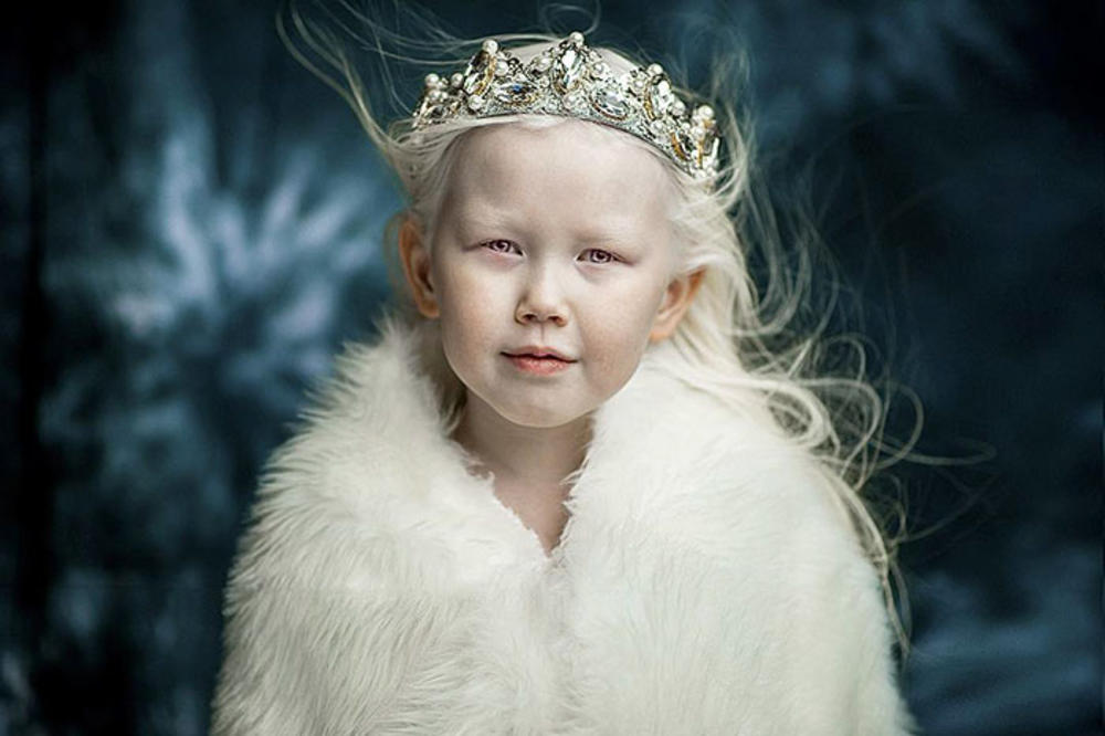 ODAVNO NISTE VIDELI NIŠTA LEPŠE! Albino devojčica (8) kao iz bajke da je došla!