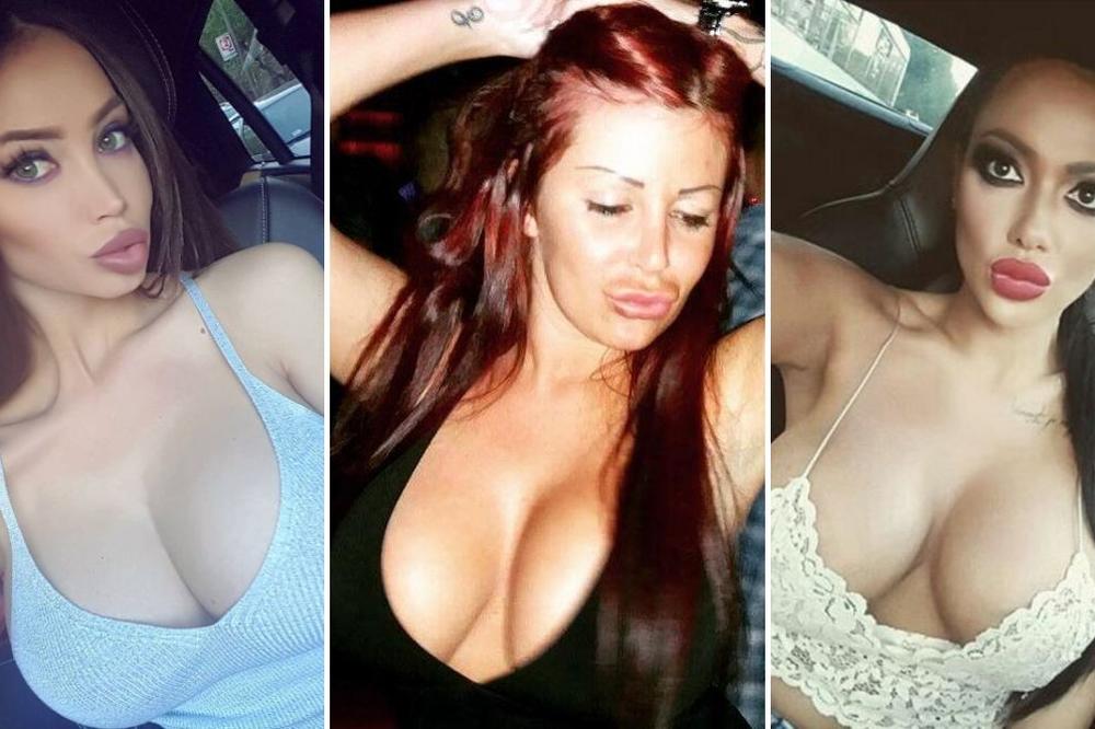 POGUBNOST PLASTIČNE HIRURGIJE! Starlete koje su otišle na "veliki servis", prednji, zadnji trap - REPARIRANI!