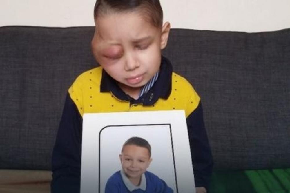 MAMA, VIDI ME KAKAV SAM, NE ŽELIM VIŠE DA ŽIVIM! I kamen bi zaplakao posle reči ovog deteta!