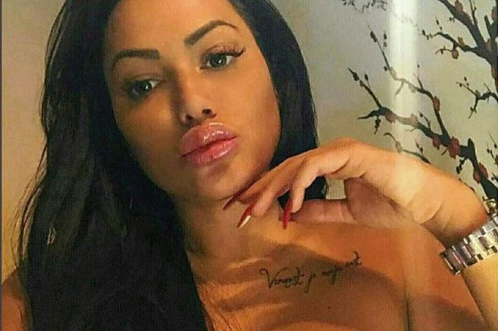 UŽASAVAJUĆA FOTKA IZ BOLNICE! Posle modre guze, Tamara pokazala i celo telo koje izgleda zastrašujuće! (FOTO)