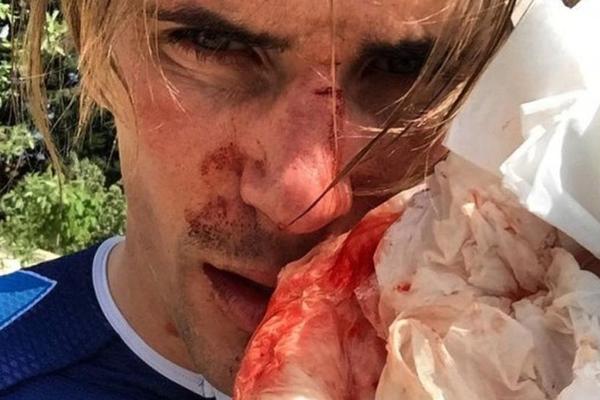 SVIREPI NAPAD: Biciklista brutalno isprebijan bejzbolkom tokom treninga! (FOTO) (VIDEO)