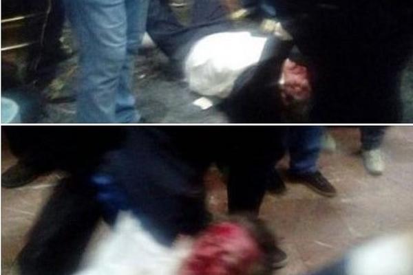 DOBRE VESTI: Zijadin Sela, pretučeni poslanik makedonskog parlamenta, nalazi se van životne opasnosti!