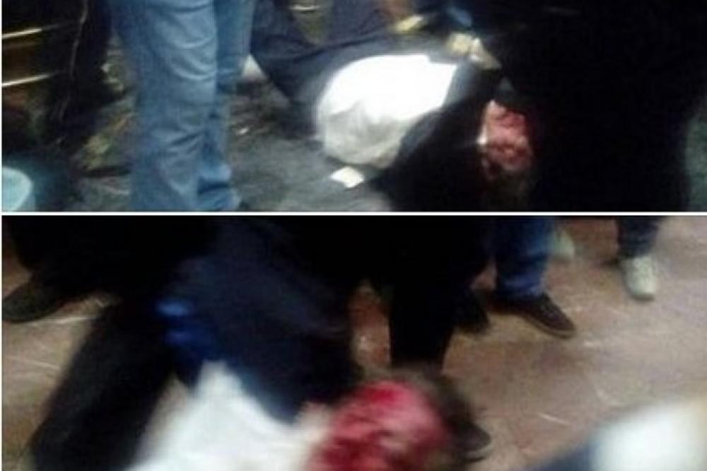 SAMO ŠTO GA NISU UBILI: Posle tuče u MAKEDONSKOM PARLAMENTU poslanik ŽIVOTNO UGROŽEN! (FOTO)