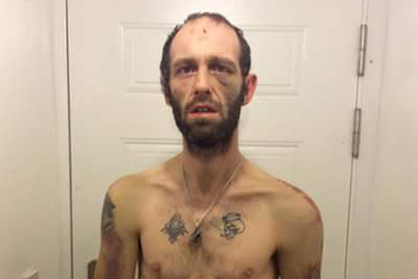 Žrtva brutalnog napada bande: Naterali su ga da pojede svoje testise, izbili mu zube i bacili telo u kesi! (FOTO)