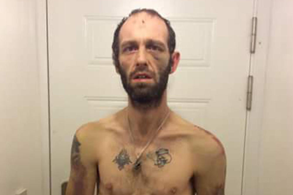 Žrtva brutalnog napada bande: Naterali su ga da pojede svoje testise, izbili mu zube i bacili telo u kesi! (FOTO)