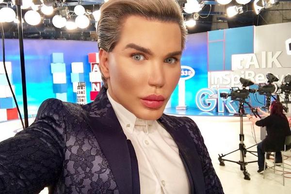 UGROŽEN ŽIVOT LJUDSKOM KENU: Posle 51 operacije, sada mu preti slepilo zbog zahvata na očnim jabučicama! (FOTO)