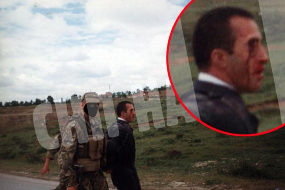 Ruski specijalci su mu objasnili neke stvari! Šok fotke PRETUČENOG RAMUŠA HARADINAJA! (FOTO)