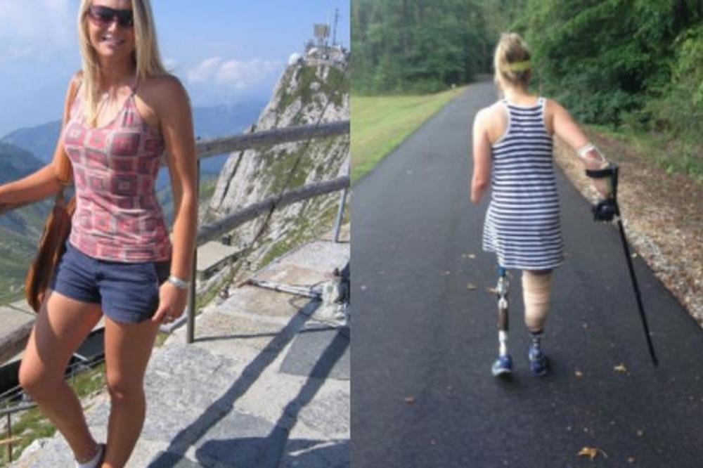 PROBUDILA SAM SE I VIDELA DA MI JE NOGA PREKO NOĆI ISTRULILA: Stravična ispovest devojke ostavlja bez reči (VIDEO)