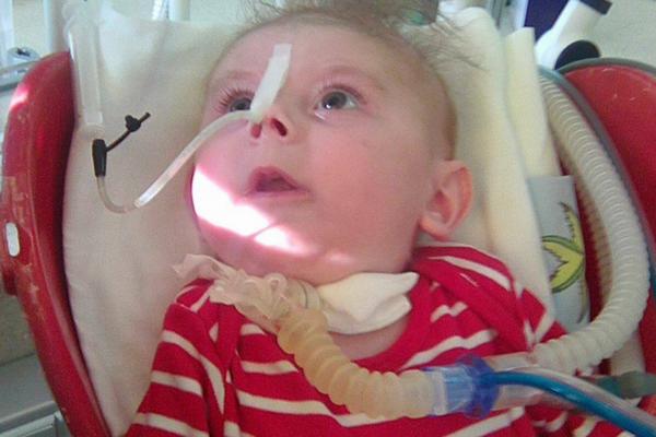 UPOZNAJTE DRAGOLJUBA KOJI SE 24h DNEVNO BORI DA PREŽIVI! Problem ovog mališana slomiće vam srce!