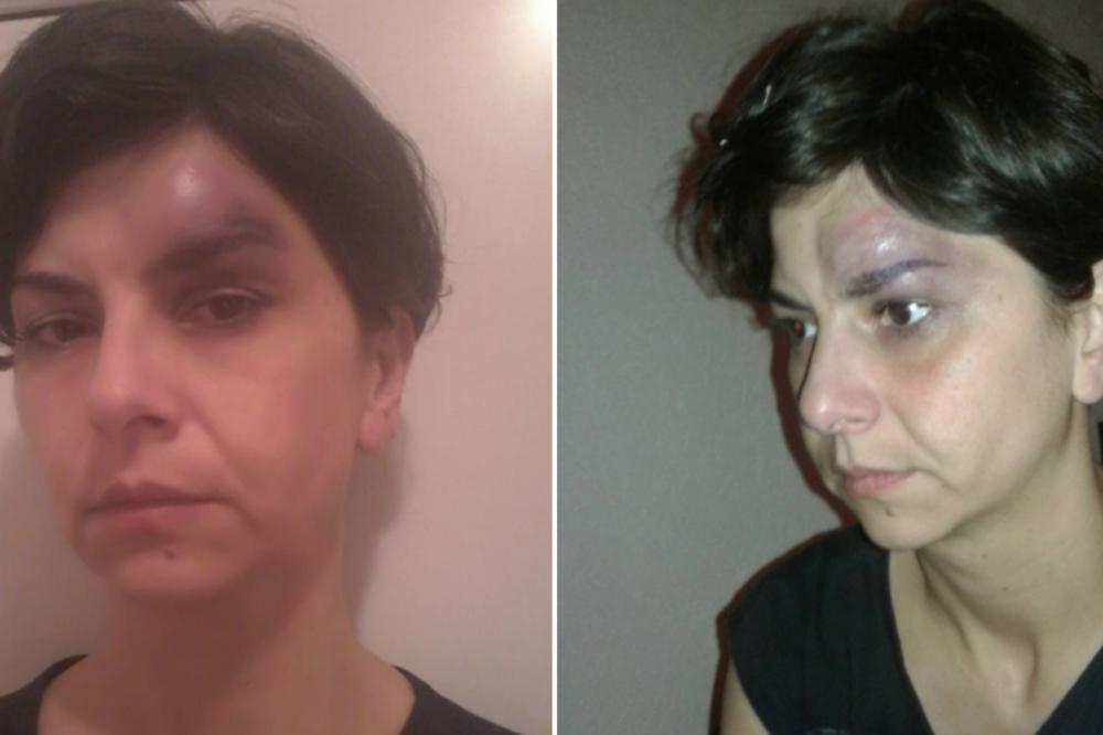 VLAST I ZAKON MU NE MOGU NIŠTA! Pretučena majka dvoje dece objavila fotografije modrog lica i zgranula sve! (FOTO)