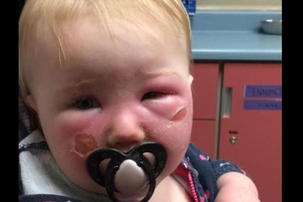 NAMAZALA JE BEBU KREMOM ZA SUNČANJE, I DESIO SE HOROR: Sada kaže da više NE VERUJE OVIM PREPARATIMA!