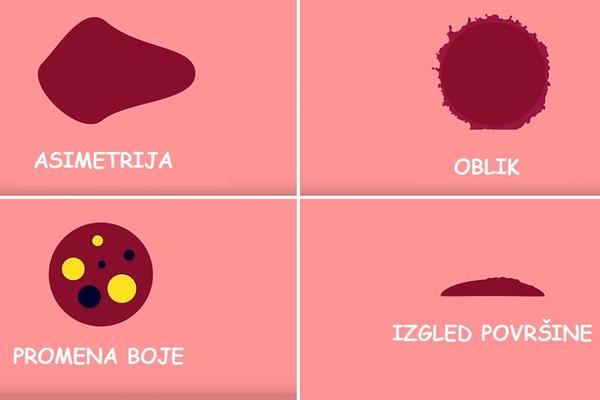 Najlakši pregled mladeža ikad, a možete to i sami uz tehniku ABCDE! (FOTO) (GIF)