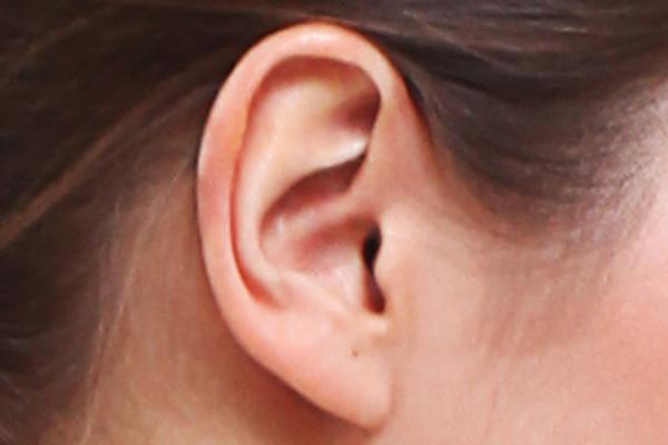 STAVILA JE ŠTIPALJKU NA UVO i posle sat vremena osetila je nešto što nikad pre nije osetila