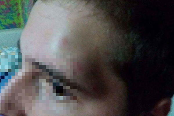 DETE IM DOŠLO S PODLIVIMA IZ ŠKOLE, U ŠKOLI ĆUTALI? Novi slučaj vršnjačkog nasilja u Nišu!