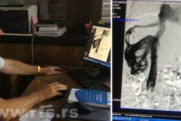 VELIKI USPEH LEKARA VMA: Pacijentkinji ugrađena veštačka vena!