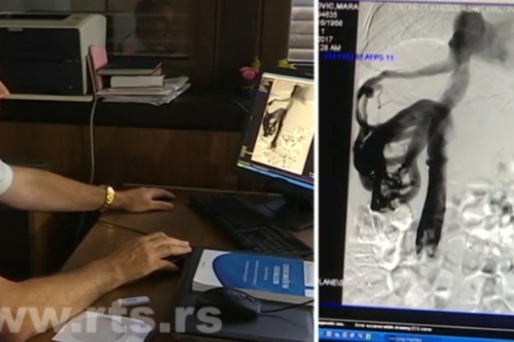 VELIKI USPEH LEKARA VMA: Pacijentkinji ugrađena veštačka vena!