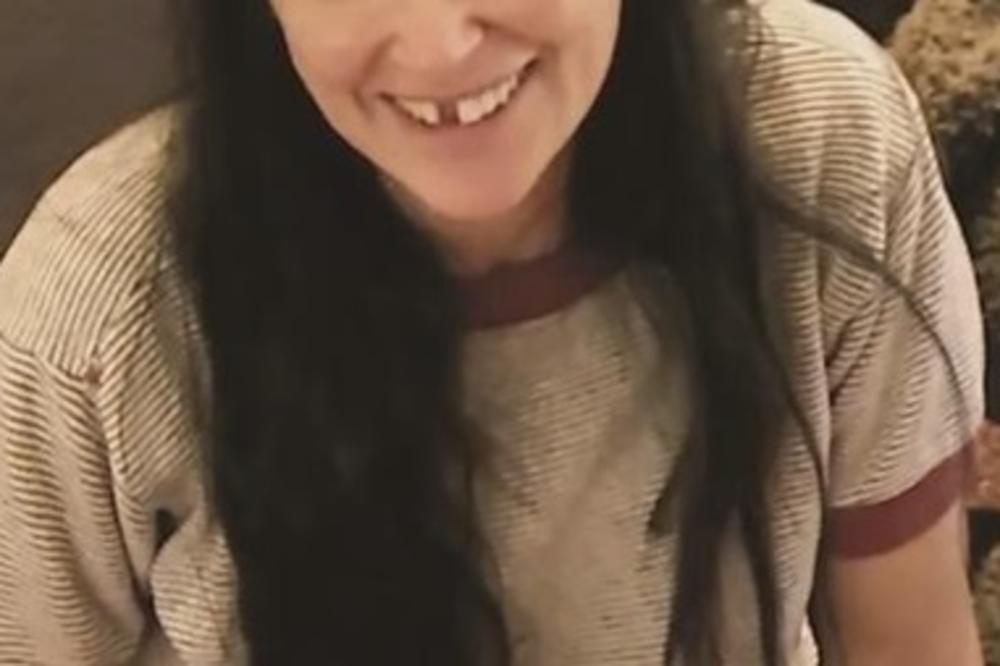 BOLUJE OD PROBLEMA KOJI POGAĐA VEĆINU LJUDI! Seks simbol DEVEDESETIH ostala bez dva prednja zuba! (FOTO)