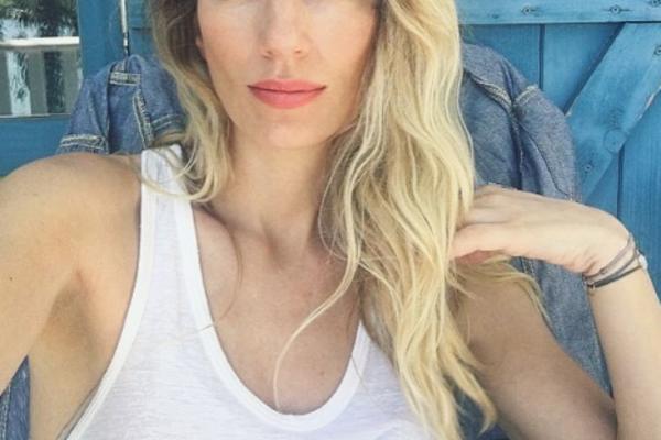 KRVAVI NASTUP POZNATE PEVAČICE! Zaradila tri kopče na glavi, posekotinu, sve je to teško podnela!