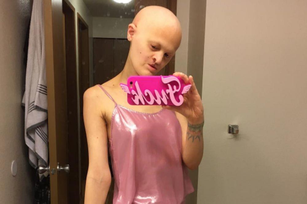 Zvali su je NAKAZA, smejali joj se, a ona sada zarađuje MILIONE: Zbog bolesti nema KOSU i ZUBE i to ju je učinilo POSEBNOM! (FOTO)