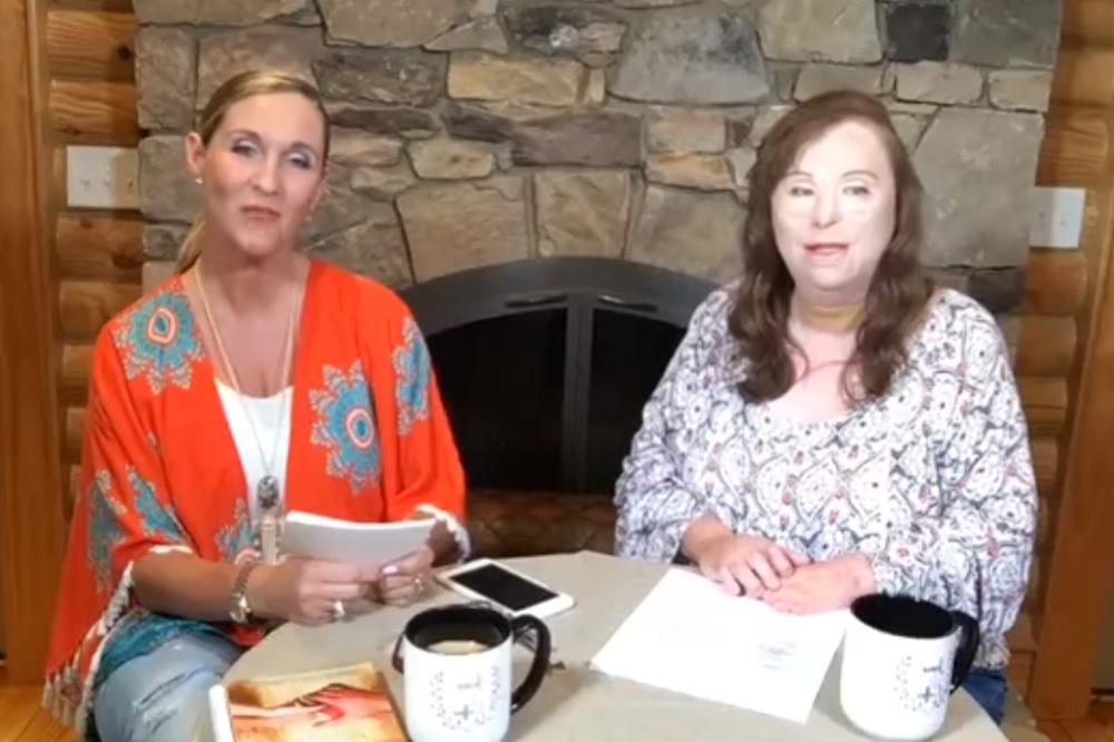 Vrištala je pred ogledalom i htela da se ubije, zvali su je NAKAZA: Posle 100 operacija, rezultat je sledeći! (FOTO) (VIDEO)