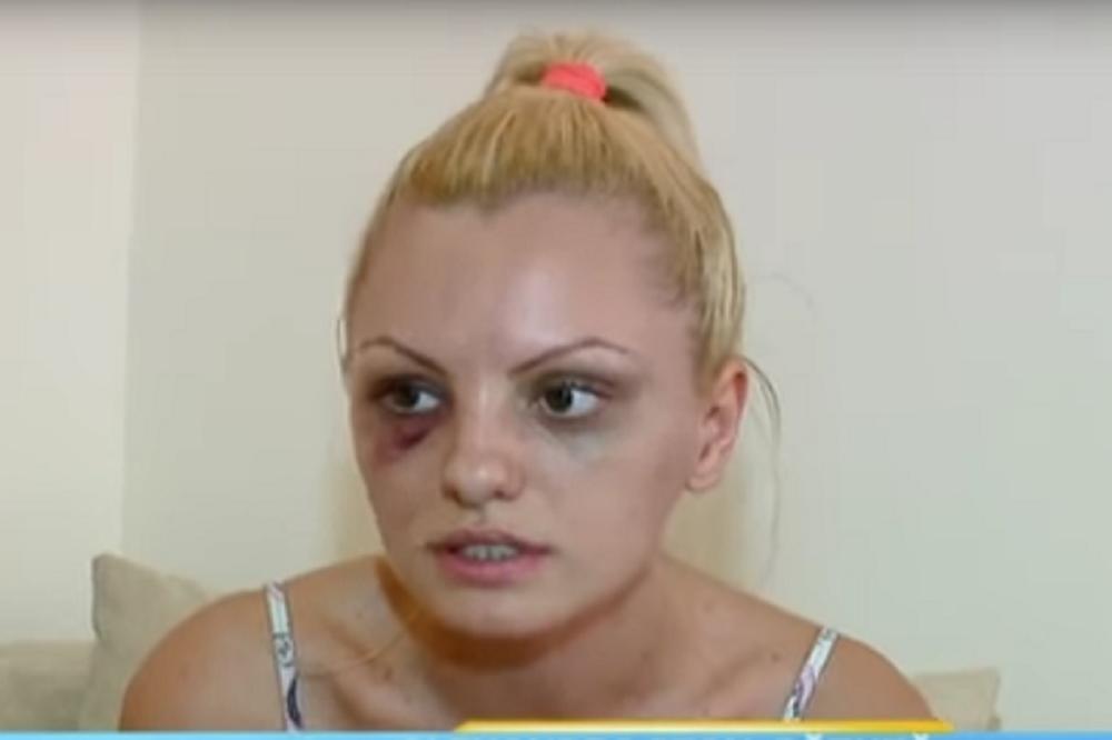 Pre tri godine pevačica je brutalno pretučena, danas izgleda OVAKO! (FOTO) (VIDEO)