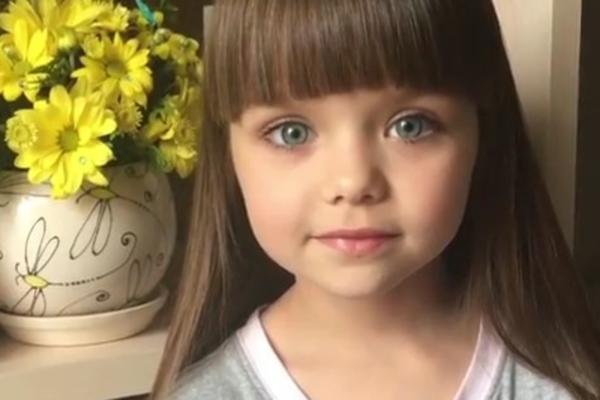 NAJLEPŠA DEVOJČICA NA SVETU JE NAPUNILA 6 GODINA: Njena lepota topila je srca širom sveta, a sada... (FOTO)