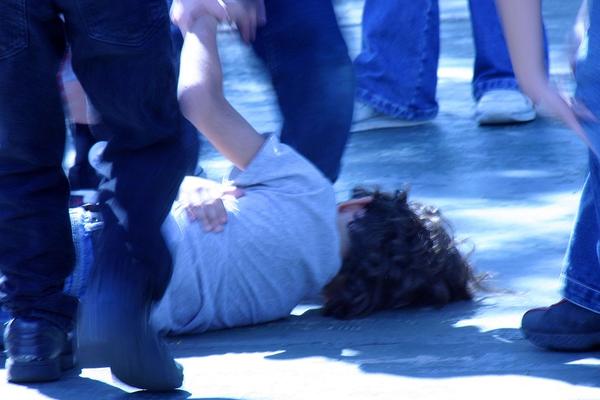 IZLOMIO MU RUKE! MALOLETNI SIN POLICAJCA dečaku na igralištu naneo TEŠKE POVREDE!