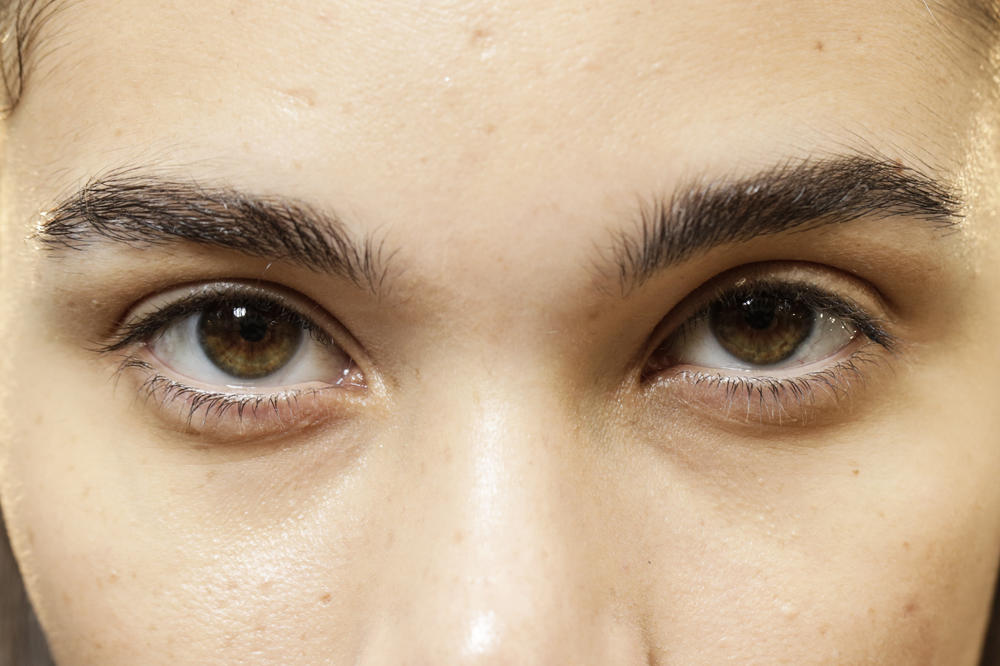 EVO ŠTA SU ZAPRAVO PODOČNJACI: Kolutovi ispod očiju ne stvaraju se OD UMORA, ovo je ISTINA