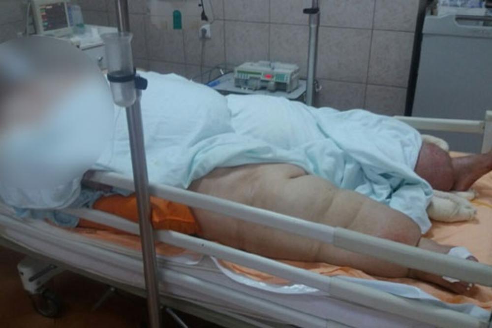 DRAMA U BORU: Lekari se bore za život ŽENE TEŠKE 300 KG, upućena pomoć iz Beograda!