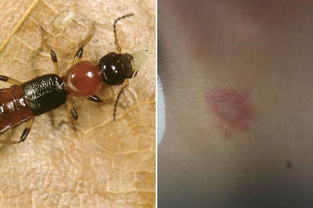 PEDERUS NAPADA SRBIJU! Čim pokušate da ga se otarasite, baca otrov na vas! (FOTO)