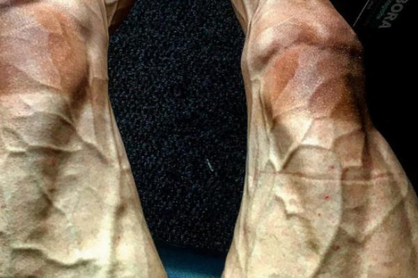 JEZIVO! Možete li da pogodite kojim sportom se bavi čovek kome noge izgledaju ovako, a nije bodibilding? (FOTO) (VIDEO)