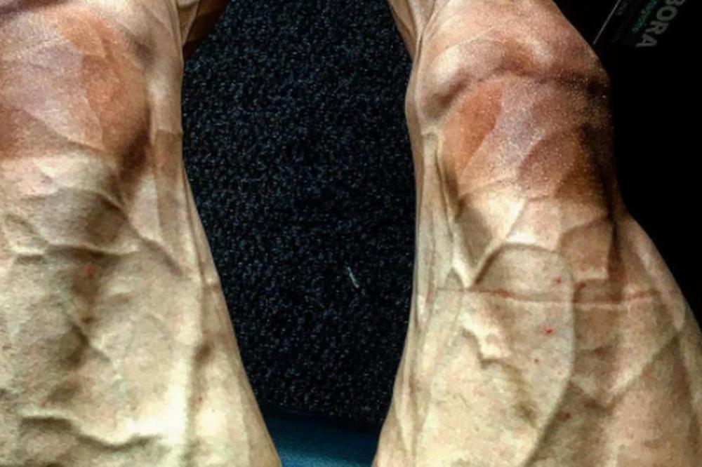 JEZIVO! Možete li da pogodite kojim sportom se bavi čovek kome noge izgledaju ovako, a nije bodibilding? (FOTO) (VIDEO)