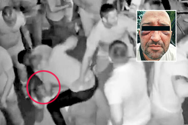 POPIO BATINE OD POLICAJACA I TO S RAZLOGOM?! Brutalan preokret: Šta zasita stoji iza krvničkog prebijanja pevača u Temerinu (FOTO) (VIDEO)