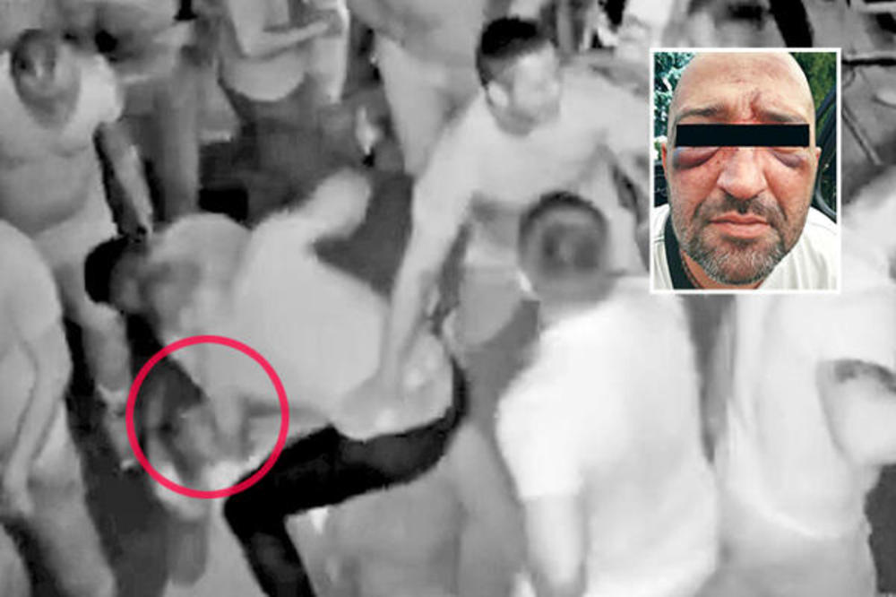 POPIO BATINE OD POLICAJACA I TO S RAZLOGOM?! Brutalan preokret: Šta zasita stoji iza krvničkog prebijanja pevača u Temerinu (FOTO) (VIDEO)