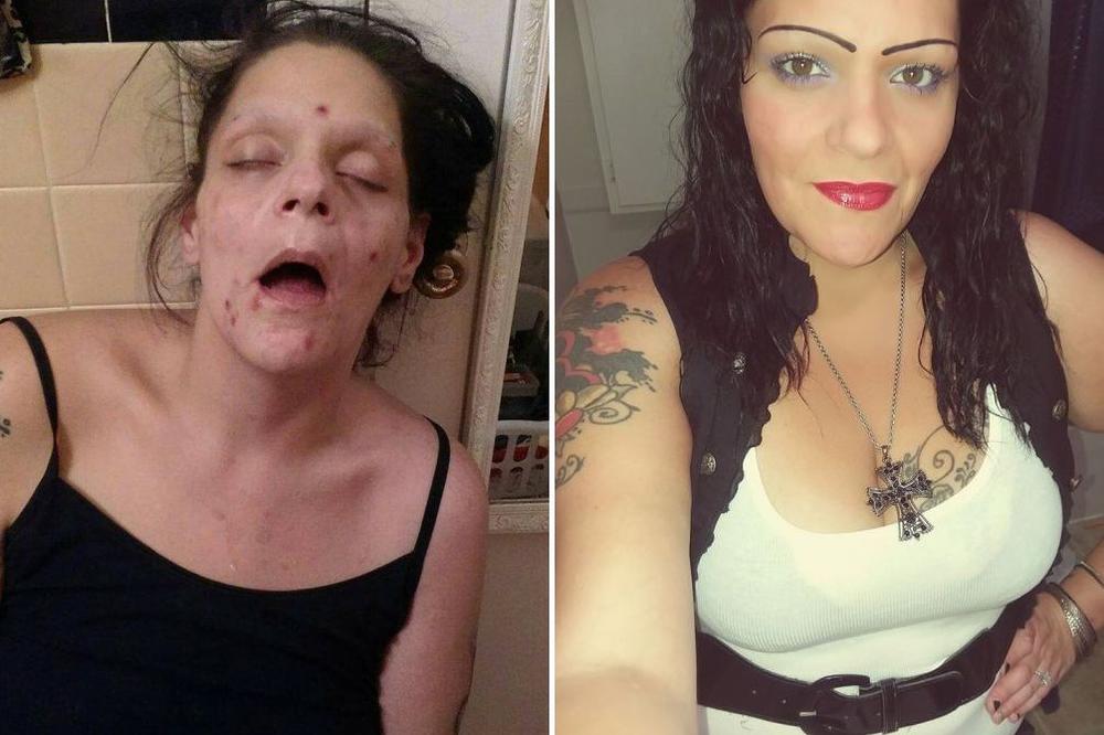BILA SAM KAO ZOMBI, MISLILA SAM DA JE GOTOVO! Jeziva ispovest bivše narkomanke! (FOTO)