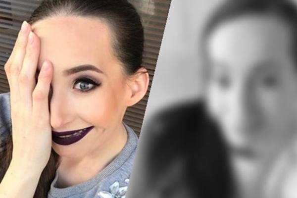 IVANKA JE GODINAMA ZBOG POREMEĆAJA SKRIVALA DESNU POLOVINU LICA: Danas je ponosno pokazuje! (FOTO)