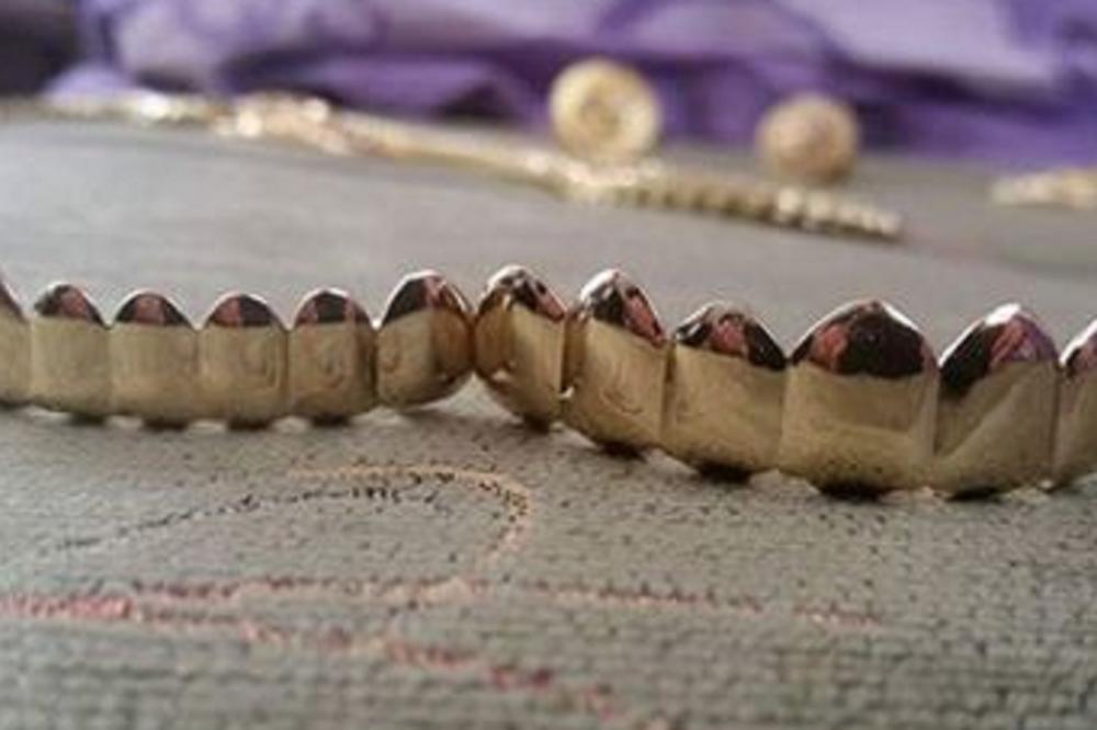 Welcome to Bosnia and Herzegovina: Ženi IZ USTA ukrali zubnu protezu!