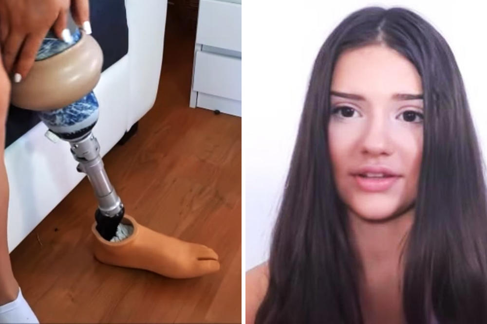 NISAM PLAKALA KAD SAM OSTALA BEZ NOGE. NEĆU NI SAD: Biljana (13) je pobedila rak i ŽIVI PUNIM PLUĆIMA (VIDEO)