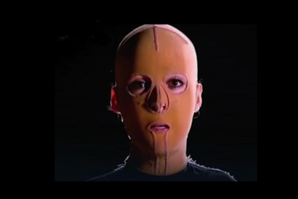 SRPKINJU DANU JE ZAPALILA LJUBOMORNA ŽENA: Kosa mi je izgorela za par sekundi, koža mi je otpadala! (FOTO) (VIDEO)