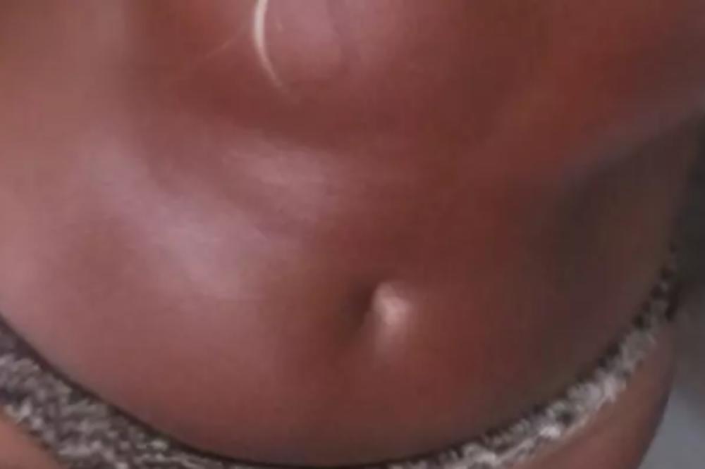 OVO JE BOLESNO! PEVAČICA SE SPRŽILA NA MORU: Ostala joj samo kosa...(FOTO)