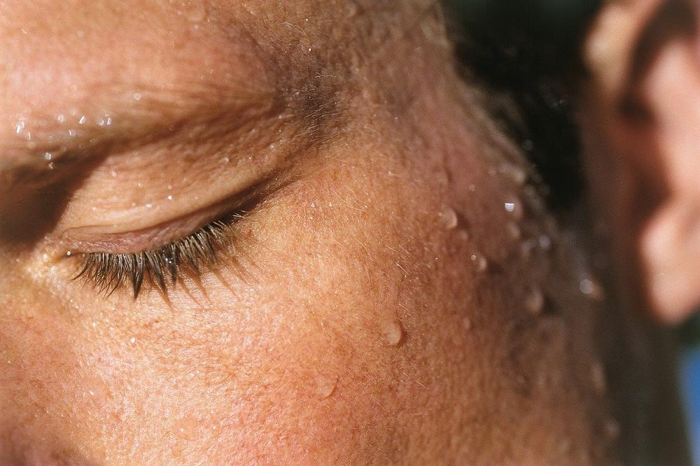 Ako se ZNOJITE TOKOM NOĆI možda imate baš ovu SMRTONOSNU BOLEST: Što pre da idite kod lekara! (FOTO) (GIF)