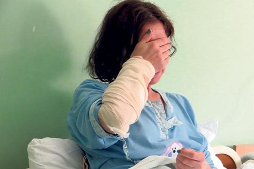 Žena me je POLILA KISELINOM i rekla da sam to ZASLUŽILA! Počela sam cela da gorim! STRAŠNA ISPOVEST SLAĐANE IZ NIŠA (FOTO)