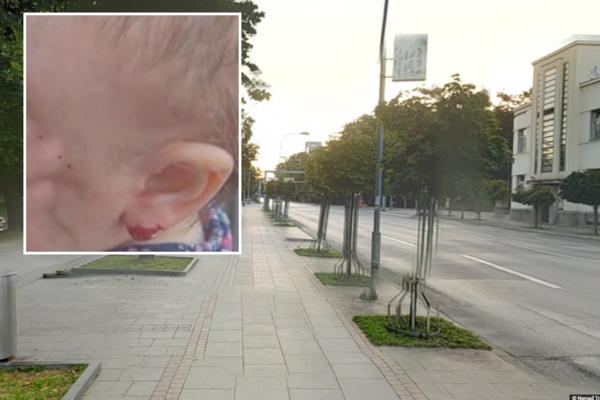 RODITELJI OGORČENI NA VASPITAČICU, KOLEGE JE BRANE: Nije ona kriva što je beba izujedana, čuvala je 28 dece! (FOTO)