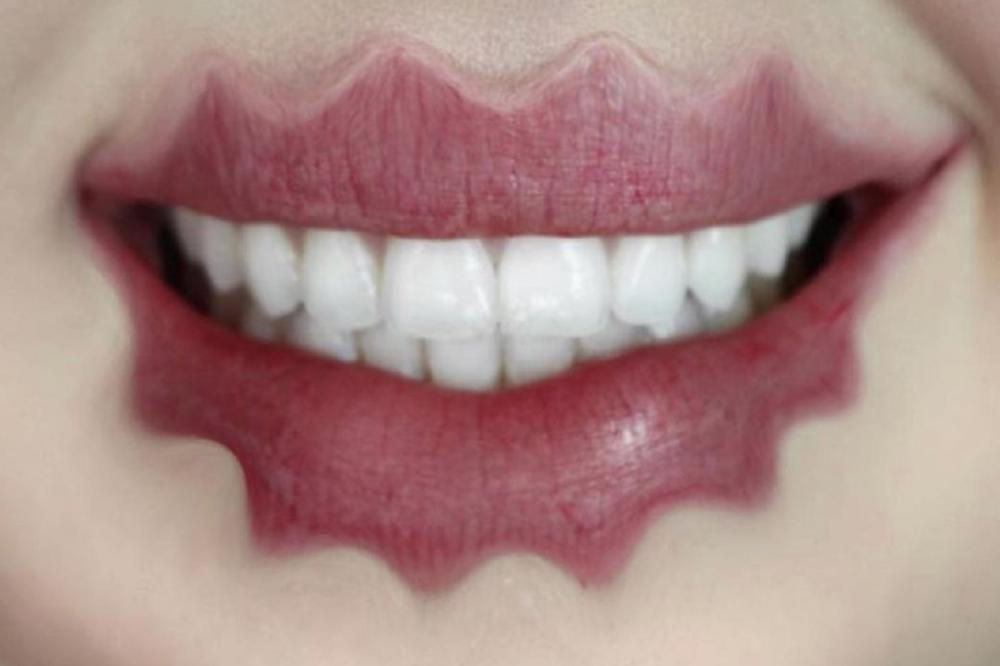 To su ti zmijska usta! Novi trend talasastih usana je još bizarniji od obrva! (FOTO)