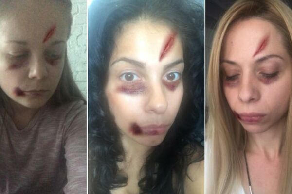 NOVINARKE ESPRESA BRUTALNO PRETUČENE! One su se usudile da izađu u javnost, ŠTA VI ČEKATE? (FOTO)