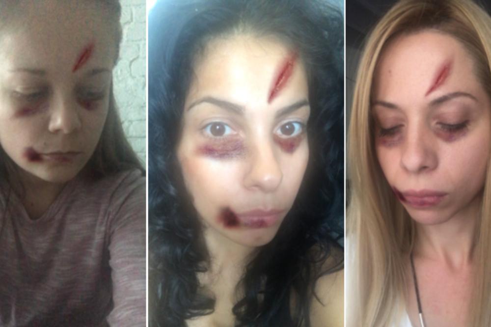 NOVINARKE ESPRESA BRUTALNO PRETUČENE! One su se usudile da izađu u javnost, ŠTA VI ČEKATE? (FOTO)