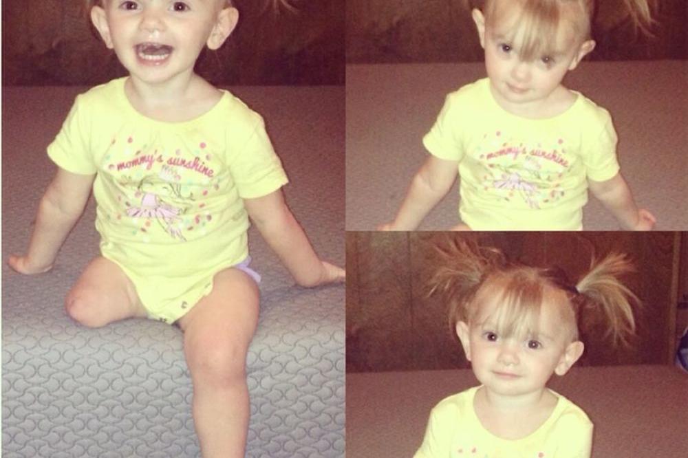 POGLEDAJTE SAMO OVOG ANĐELA: Džemi su sa 3 godine amputirali nogu, ali ona mašta da postane ČIRLIDERSICA! Njena priča je NEVEROVATNA (FOTO)