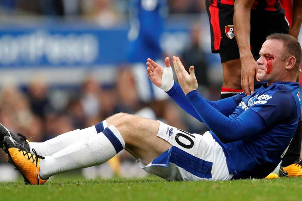 KRVNIČKI! Vejnu Runiju šikljala krv posle duela od kog se svi hvataju za glavu! (VIDEO)