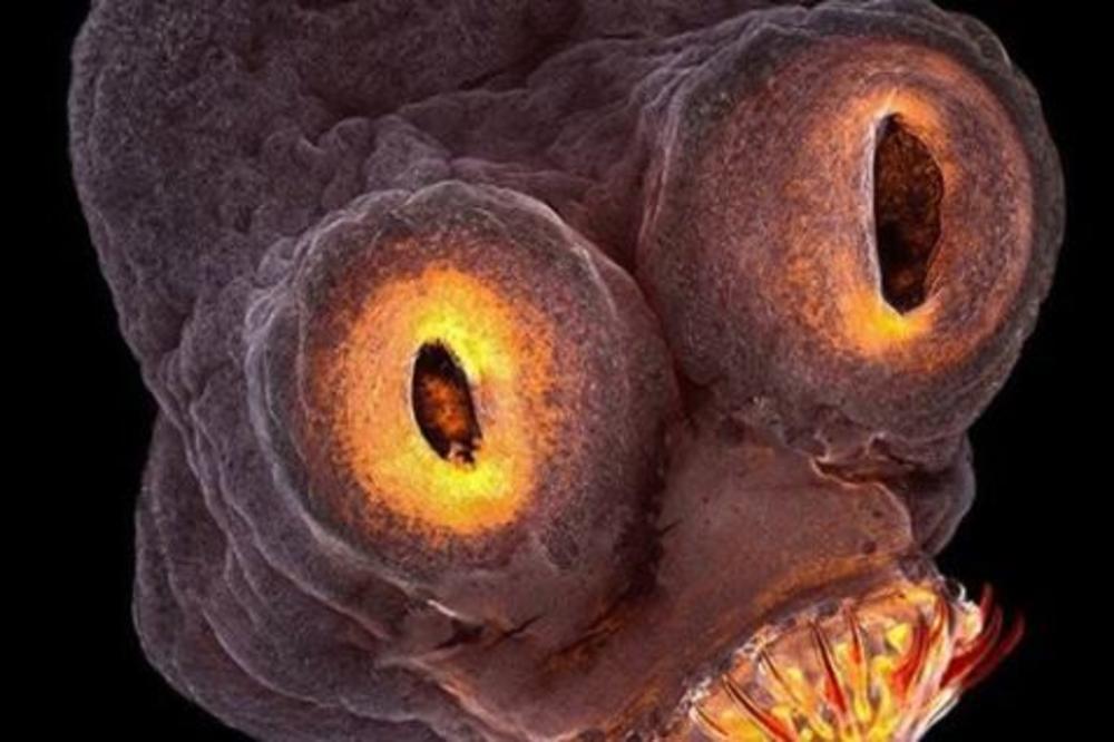 DA SE NAJEŽITE: Ovo zastrašujuće stvorenje možda ŽIVI baš u vama! Nije šala...nalazi se u dosta ljudi!