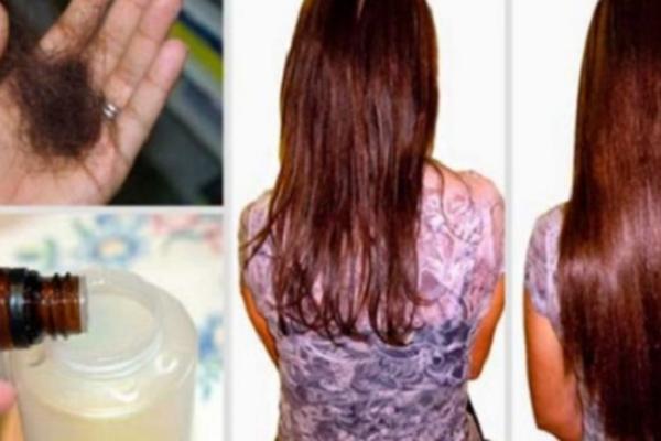 Uzela je običan litarski šampon i u njega dodala 2 kapi limuna i ova dva jeftina sastojka. Nakon 3 nedelje nije mogla samu sebe da prepozna u ogledalu!